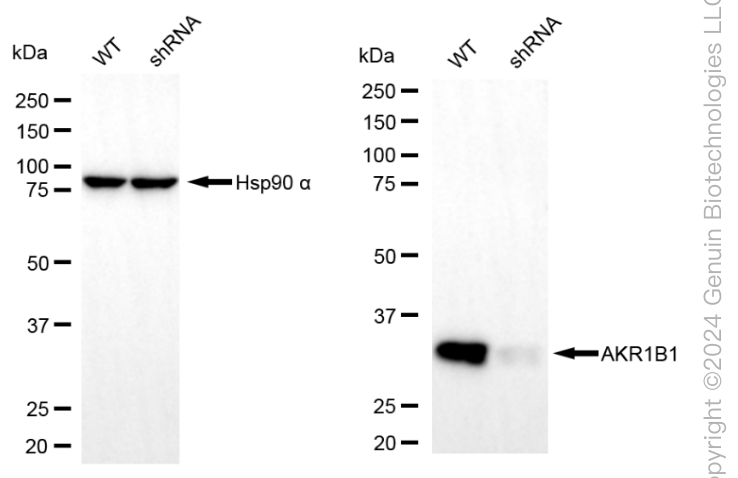 WB - KD-Validated Anti-AKR1B1 Mouse Monoclonal Antibody AGI1973